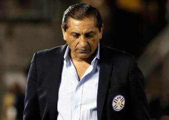 DT de Paraguay: 'Fuimos respetuosos con James'