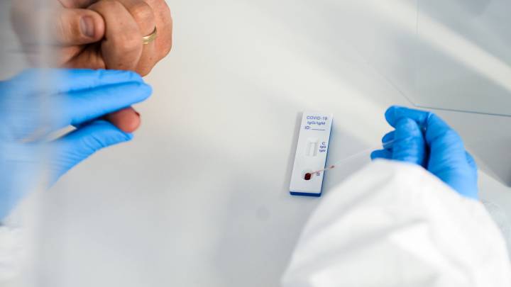 Coronavirus en Colombia: cómo funcionan los test rápidos del Covid-19