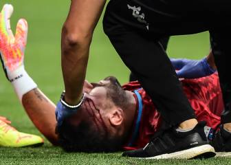 David Ospina sale con golpe y corte en la cabeza
