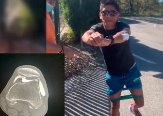 Nairo trabaja para recuperar el cartílago de su rodilla