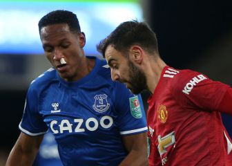 Everton, con Yerry Mina, eliminado de la Carabao Cup