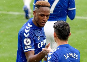 Everton - Sheff Wed: TV, horario y cómo ver online la FA Cup