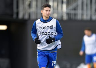 James se lesiona en calentamiento ante Aston Villa