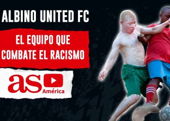 Albino United FC: Una lucha por la vida y la dignidad