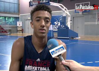 Así afecta el Síndrome de Marfan