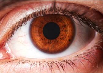 La iridología, nuestro organismo a examen a través de los ojos