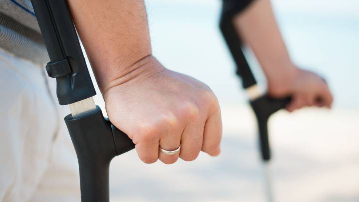 La esclerodermia afecta a dos millones de personas en todo el mundo