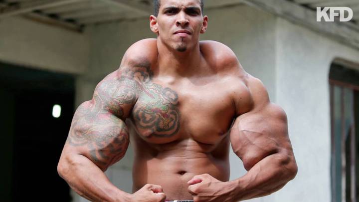 Synthol: el aceite que te hace parecer musculoso (y deforme)