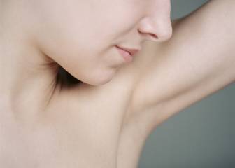 ¿Qué es y cómo afecta la Hidradenitis Supurativa?