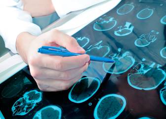 Arranca la Semana del Cerebro 2017: lo que tienes que saber