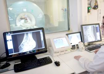 Los equipos de diagnóstico por imagen de los hospitales públicos están anticuados