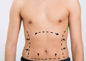 5 cirugías plásticas para que los hombres presuman de cuerpo 10