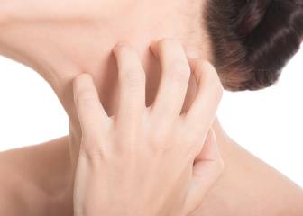 Consejos para calmar una piel atópica