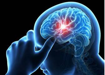 Cómo afecta al cuerpo un aneurisma cerebral