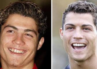 Ortodoncias para mejorar el rendimiento deportivo