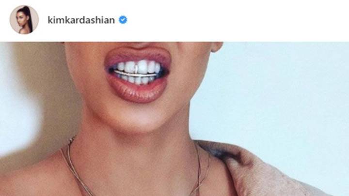 El accesorio de dientes de Kim Kardashian es un peligro