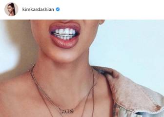 El accesorio de dientes de Kim Kardashian es un peligro