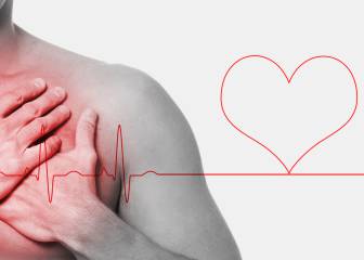 ¿Sabes reaccionar ante un paro cardiaco? Así se salva una vida