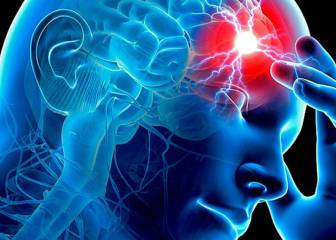 Desarrollan nuevas vías para el tratamiento del ictus