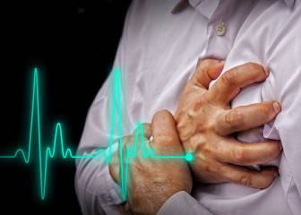 Sí, se puede prevenir un infarto