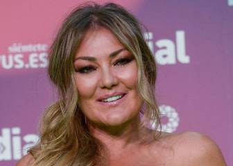 El caso Amaia Montero: ¿qué ha ocurrido en su rostro?