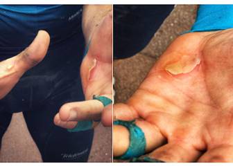 Cómo cuidar las manos tras la mítica Paris-Roubaix