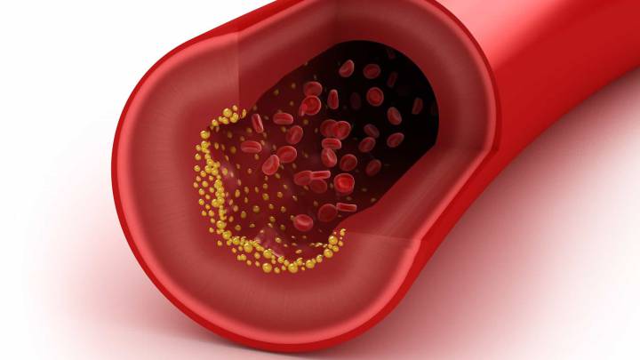 Un estudio confirma que el colesterol LDL cuanto más bajo mejor