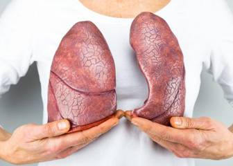 Fibrosis Quística, la enfermedad rara genética más frecuente