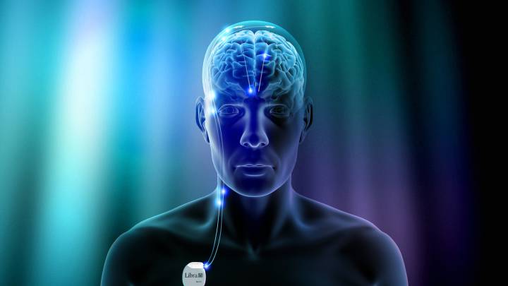 La estimulación cerebral, el futuro del tratamiento de la depresión