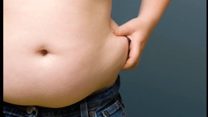 Reclaman que la cirugía bariátrica sea prioritaria para evitar la obesidad