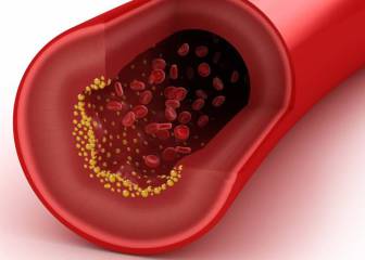 Un estudio confirma que el colesterol LDL mejor bajo