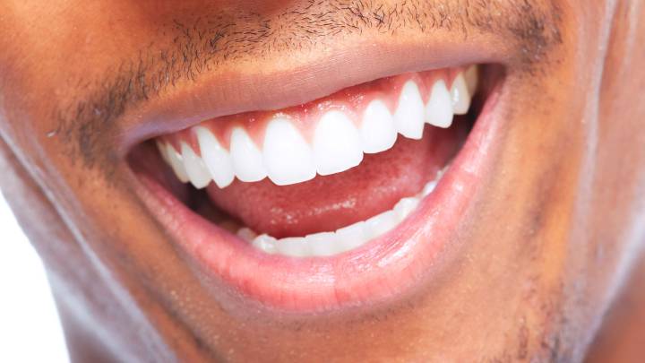 En busca de la sonrisa perfecta: la odontología está en auge