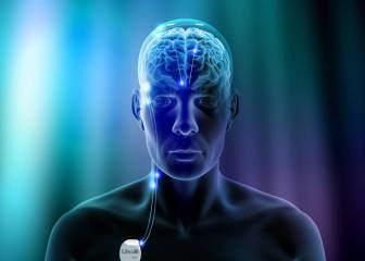 Estimulación cerebral, el futuro del tratamiento de la depresión