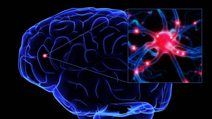 Cómo prevenir la afectación cerebral de las mucopolisacaridosis (MPS)