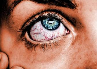 La miastenia debilita los músculos sin causa conocida