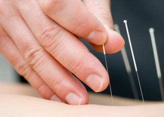 Analizamos si la acupuntura puede ayudar contra la disfunción eréctil