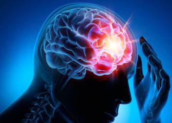 El dolor de cabeza es un verdadero problema: 14.000 consultas al mes