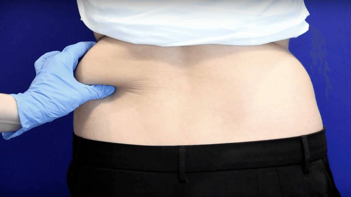 Cuál es la mejor manera de eliminar la grasa localizada en el abdomen y la  cintura