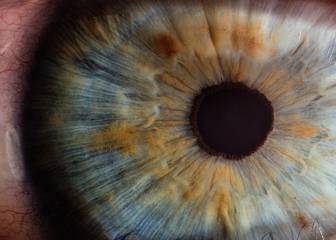 ¿Existe relación entre tres enfermedades oculares y Alzheimer?