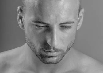 ¿Por qué ir a Turquía si contemplas un trasplante capilar?