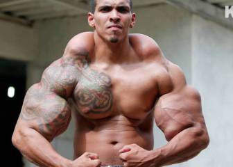 synthol