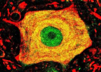 ELA, descubrimiento, hallazgo