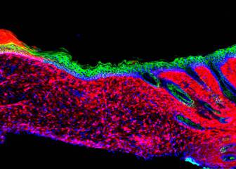 Gran avance: una nueva técnica permite la regeneración de órganos sin trasplante