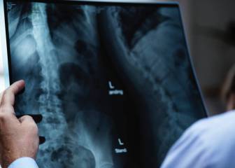 Las 5 causas específicas de muerte más habituales en España