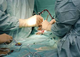 Las unidades de cuidados intermedios reducirían las listas de espera