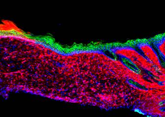 Gran avance: una nueva técnica permite la regeneración de órganos sin trasplante
