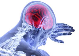 El 90% de los ictus están relacionados con factores de riesgo modificables