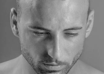 ¿Por qué ir a Turquía si contemplas un trasplante capilar?