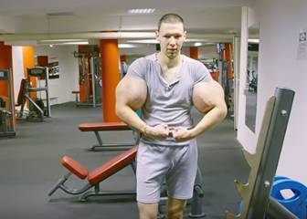 El 'Hulk' ruso se inyecta aceite en los brazos para luchar