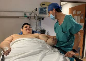 Juan Pedro Franco, obesidad, obesidad mórbida, enfermedades, salud, cirugía de obesidad